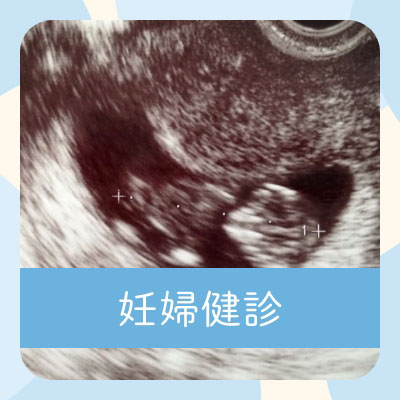 妊婦健診